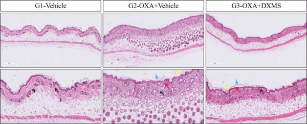 Atopic Dematitis Mouse Models - Image 6