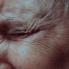 Human Epidermal Keratinocytes for Skin Research