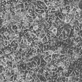 Cryopreserved Hepatocytes