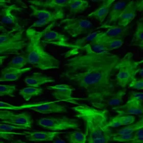 Cryopreserved Human Non-Parenchymal cells