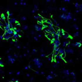 Human iPSC-derived Neural Progenitor cells (Caucasian, 1M cells)0.5 mL