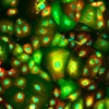 Human iPSC-derived Sebocytes (Cau, Afr, As, 2M cells) 0.5 mL