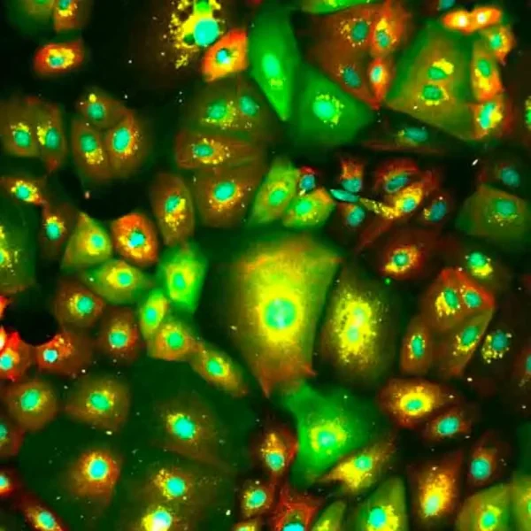 Human iPSC-derived Sebocytes (Cau, Afr, As, 2M cells) 0.5 mL