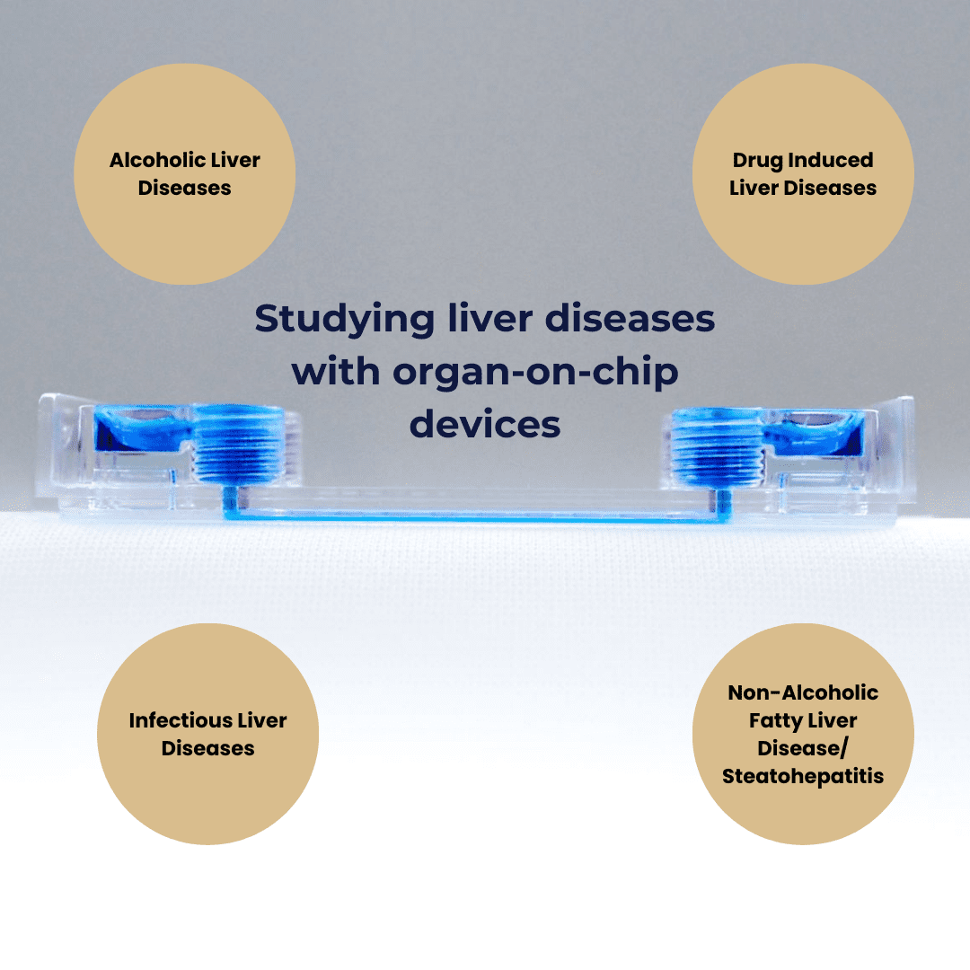 Figure 1: Different types of liver diseases that can be studied with Organ-on-Chip Devices