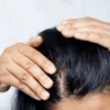 Ex-vivo Adult Human Scalp with Hair Follicules, Full Thickness