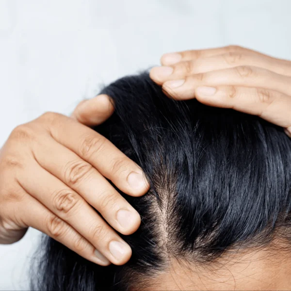 Ex-vivo Adult Human Scalp with Hair Follicules, Full Thickness