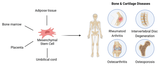 Mesenchymal stem cells therapy application for bone and cartilage diseases