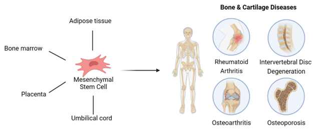 การประยุกต์ใช้ Mesenchymal Stem Cell สำหรับโรคกระดูกและกระดูกอ่อน