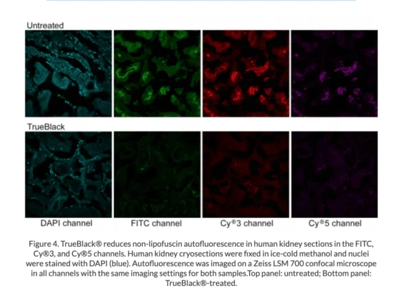 TrueBlack® Lipofuscin Autofluorescence Quencher - Image 5