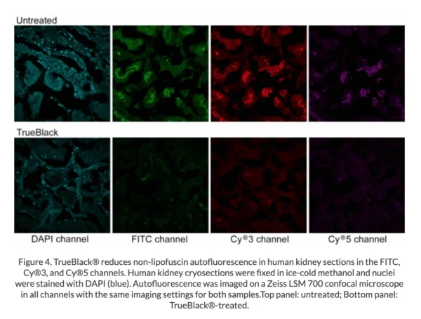 TrueBlack® Lipofuscin Autofluorescence Quencher - Image 6