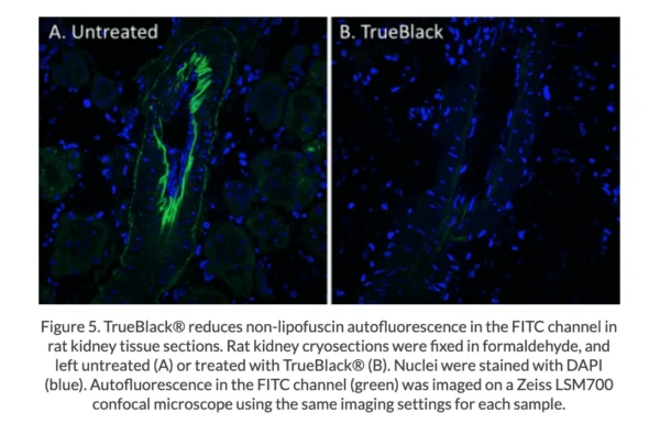 TrueBlack® Lipofuscin Autofluorescence Quencher - Image 7