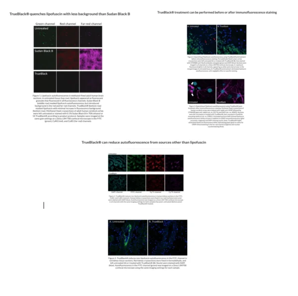 TrueBlack® Lipofuscin Autofluorescence Quencher - Image 8