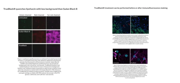 TrueBlack® Lipofuscin Autofluorescence Quencher - Image 9