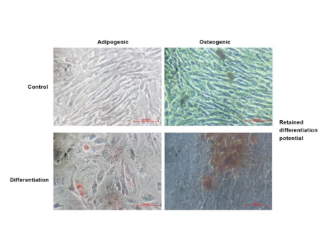 Mesenchymal stem cell picture showing differential potential of Adipogenic hMSCs and Osteogenic hMSCs.