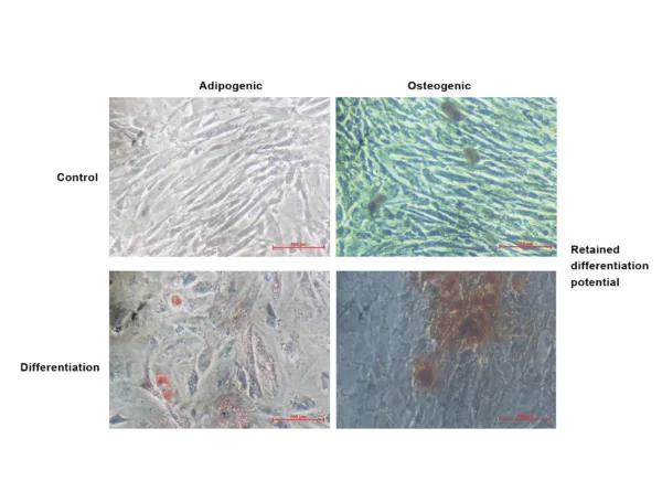 Mesenchymal stem cell picture showing differential potential of Adipogenic hMSCs and Osteogenic hMSCs.