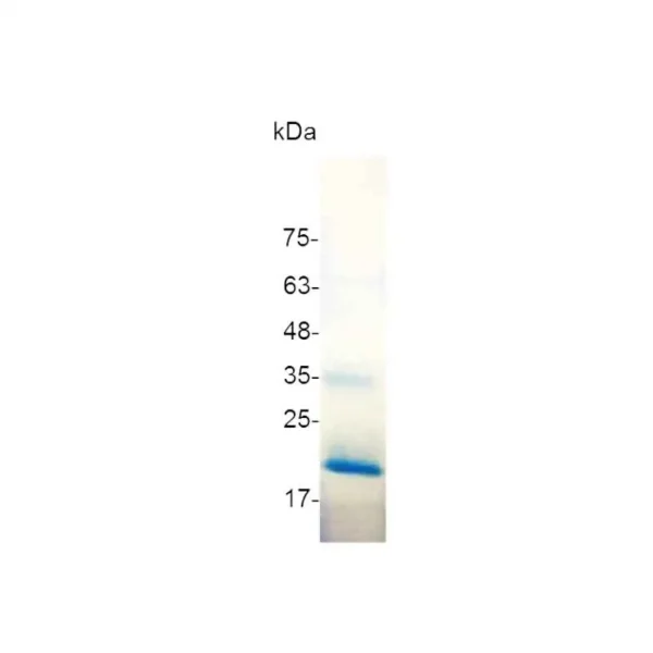 4-1BBL, Human - Image 2