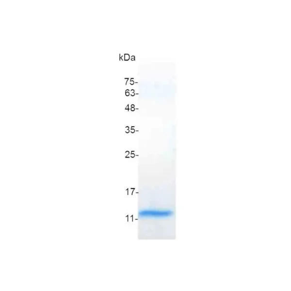 CCL2, Human - Image 2