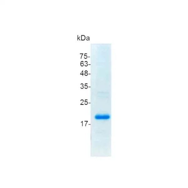 CD30L, Human - Image 2