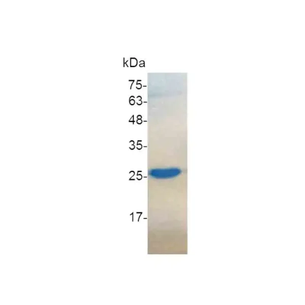 CNTF, Human - Image 2