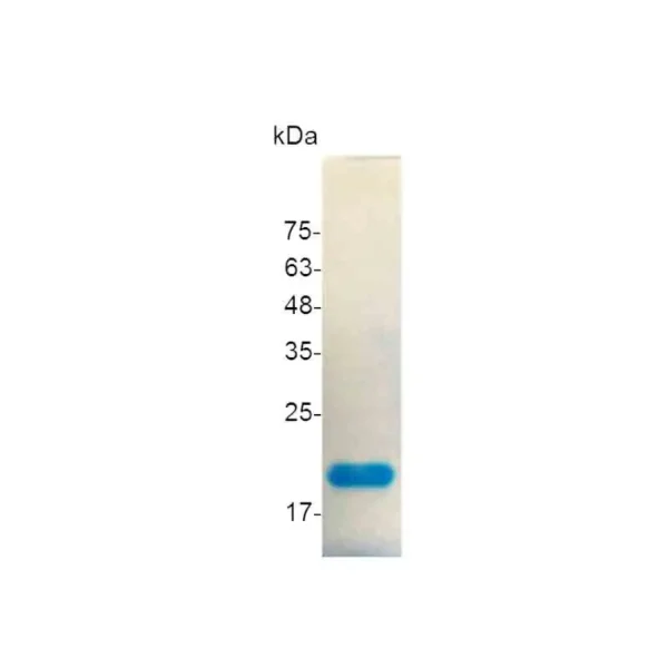 Croyez GMP® GM-CSF, Human - Image 2