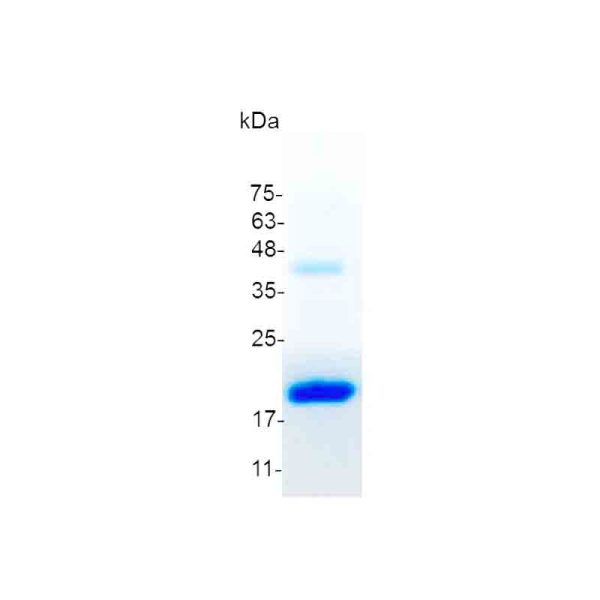 Flt-3 Ligand, Mouse - Image 2