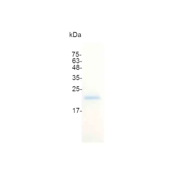 G-CSF, Human - Image 2