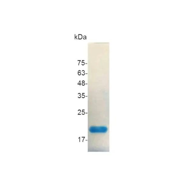 GM-CSF, Human - Image 2