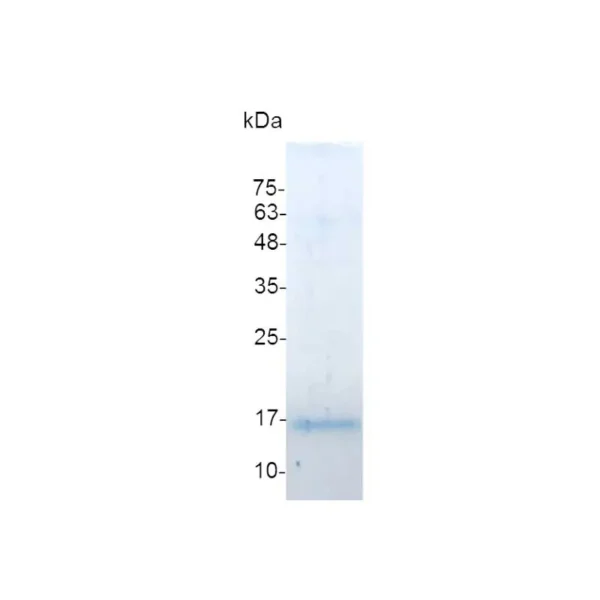 Galectin-13, Human - Image 2