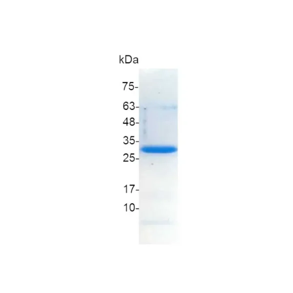 Galectin-3, Human - Image 2
