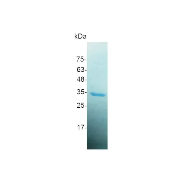 HMGB1, Human - Image 2