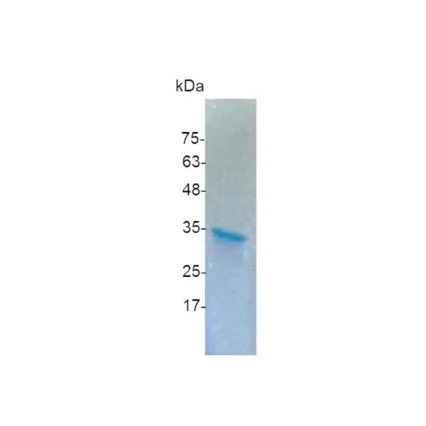 HMGB2, Human - Image 2
