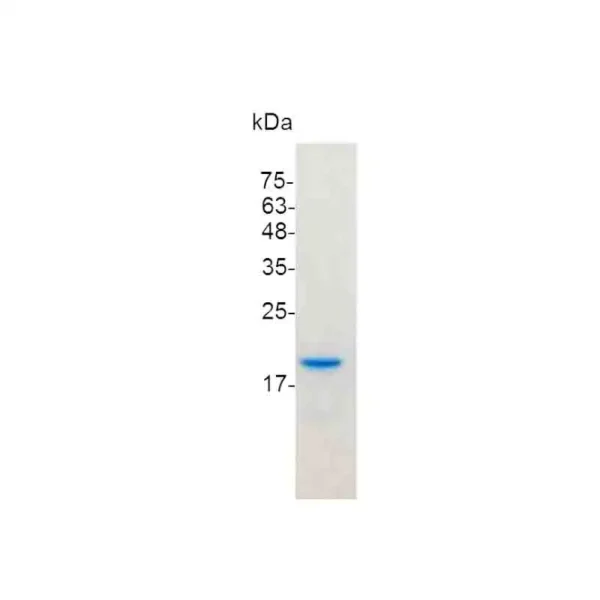 IFN beta 1a, Mouse - Image 2