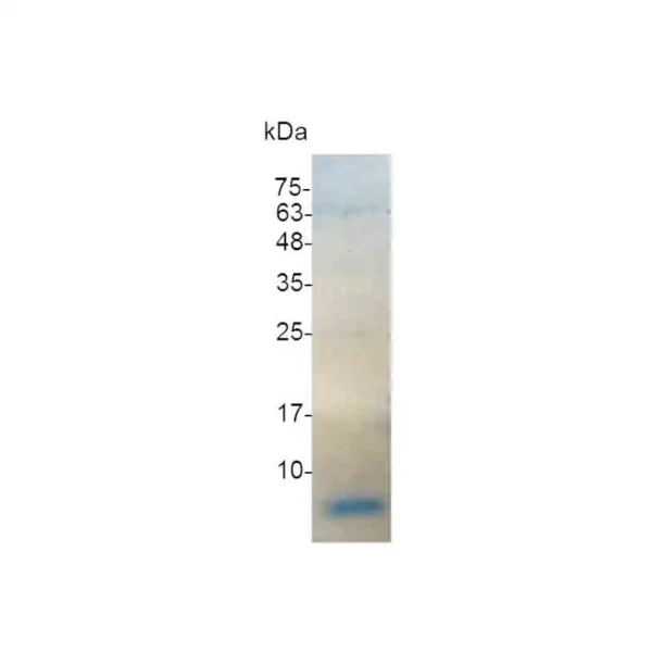 IGF-I, Human - Image 2