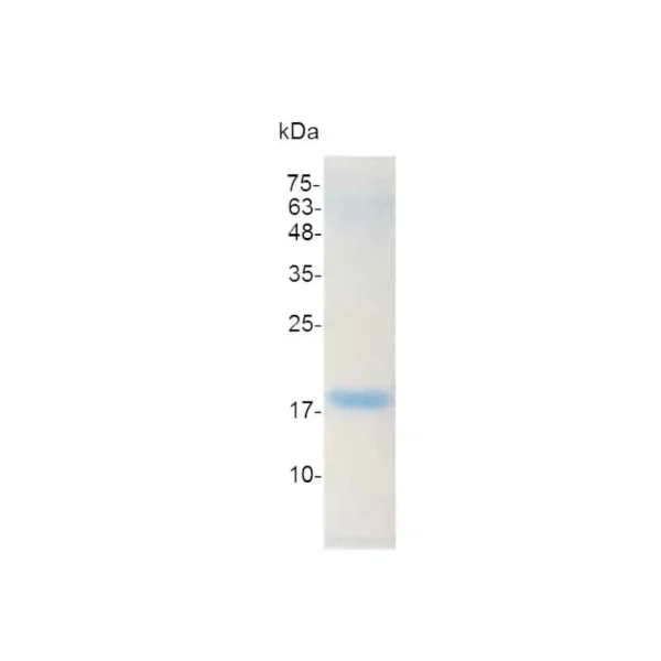 IL-1 beta, Human - Image 2