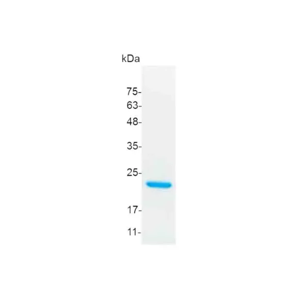IL-11, Mouse - Image 2