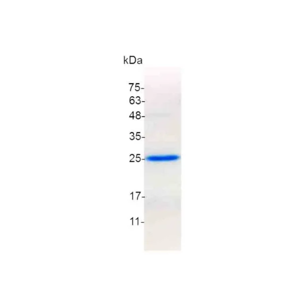 IL-12 p35, Mouse - Image 2