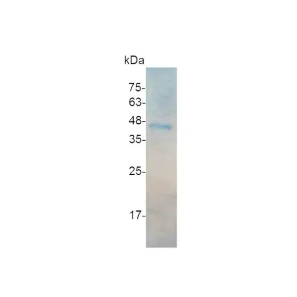 IL-12 p40, Human - Image 2