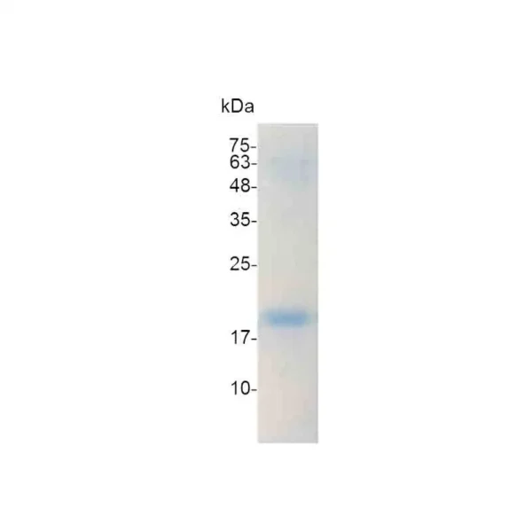 IL-16 (129 a.a.), Human - Image 2