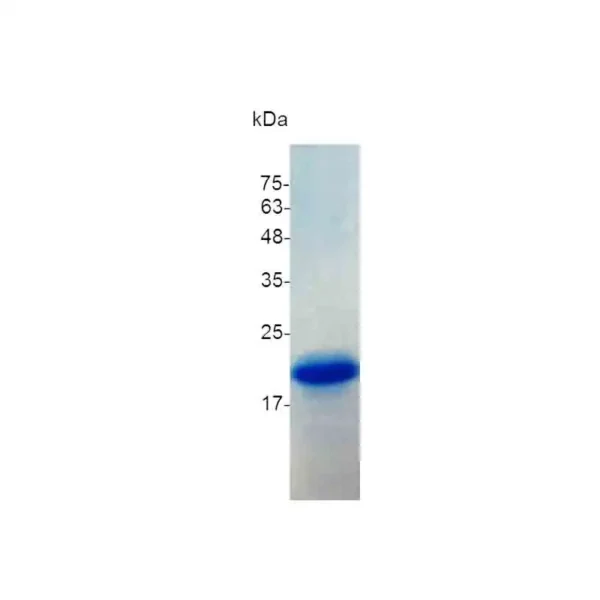 IL-1RA, Human - Image 2