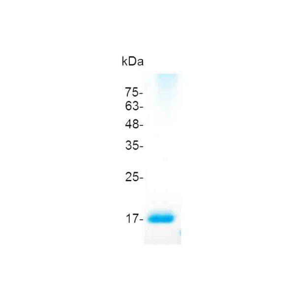 IL-36RA, Human - Image 2