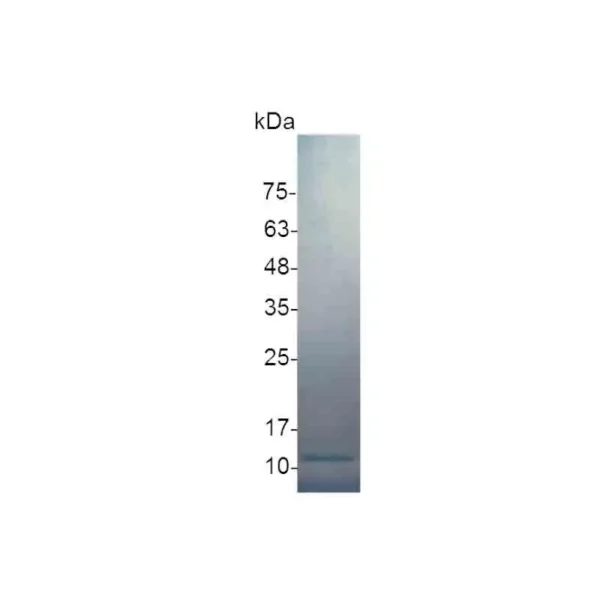 IL-8 (72 a.a.), Human - Image 2