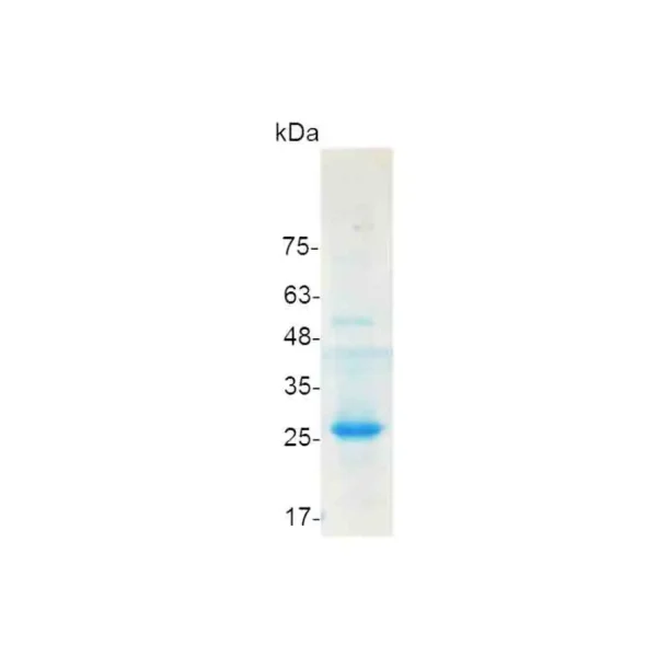 MMP7 (proenzyme), Human - Image 2