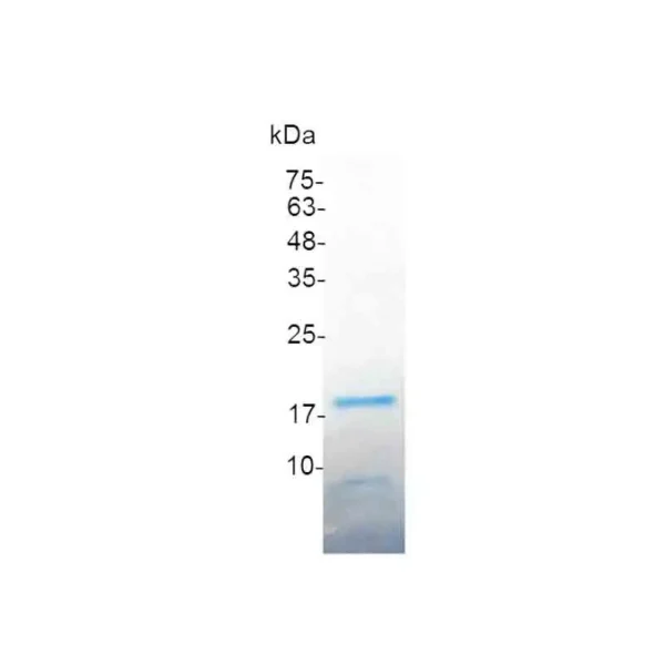 RANKL, Human - Image 2