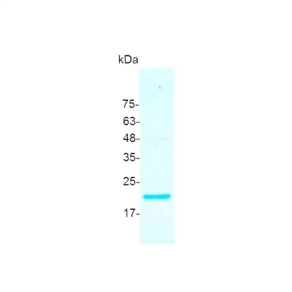 TPO, Human - Image 2