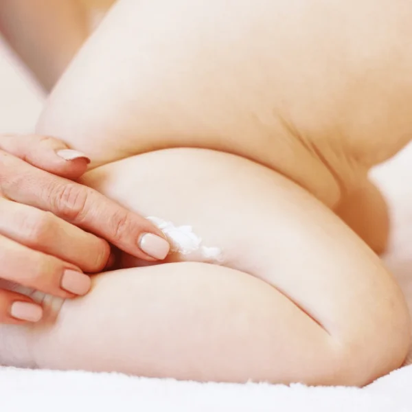 CTIBiotech BABY SKIN® Kit For In-Vitro Tests