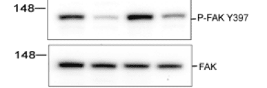 Protein detection using Radiance ECL western blot substrate.