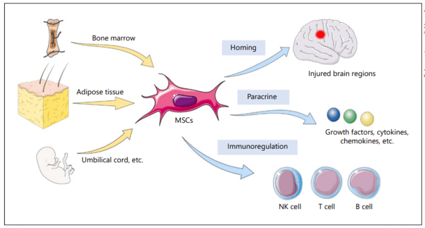 Illustration of the sources to derive Mesenchymal Stem Cells (MSCs) and its application as homing agent for injured brain regions, paracrine agent as growth factors, cytokines, chemokines and immunoregulators for NK cell, T cell and B cell.   
