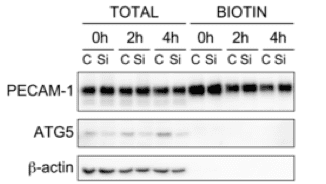 Autophagy proteins detection from HUVEC cells detection using Radiance Plus western blot substrate.