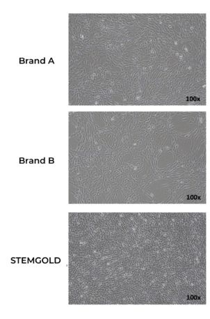 3가지 다른 배지(aMEM, StemMACS, STEMGOLD)에서의 중간엽 줄기세포 성장 비교