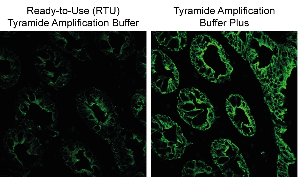 PanCK staining in human colon cryosections detected using CF®488A tyramide with Ready-to-Use Tyramide Amplification Buffer (left), or Tyramide Amplification Buffer Plus (right). Amplification Buffer Plus gives brighter signal compared to original Ready-to-Use Tyramide Amplification Buffer.